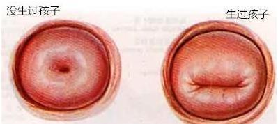 顺产阴道视频,真实视频记录